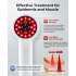 Portable Handheld Laser Therapy Device